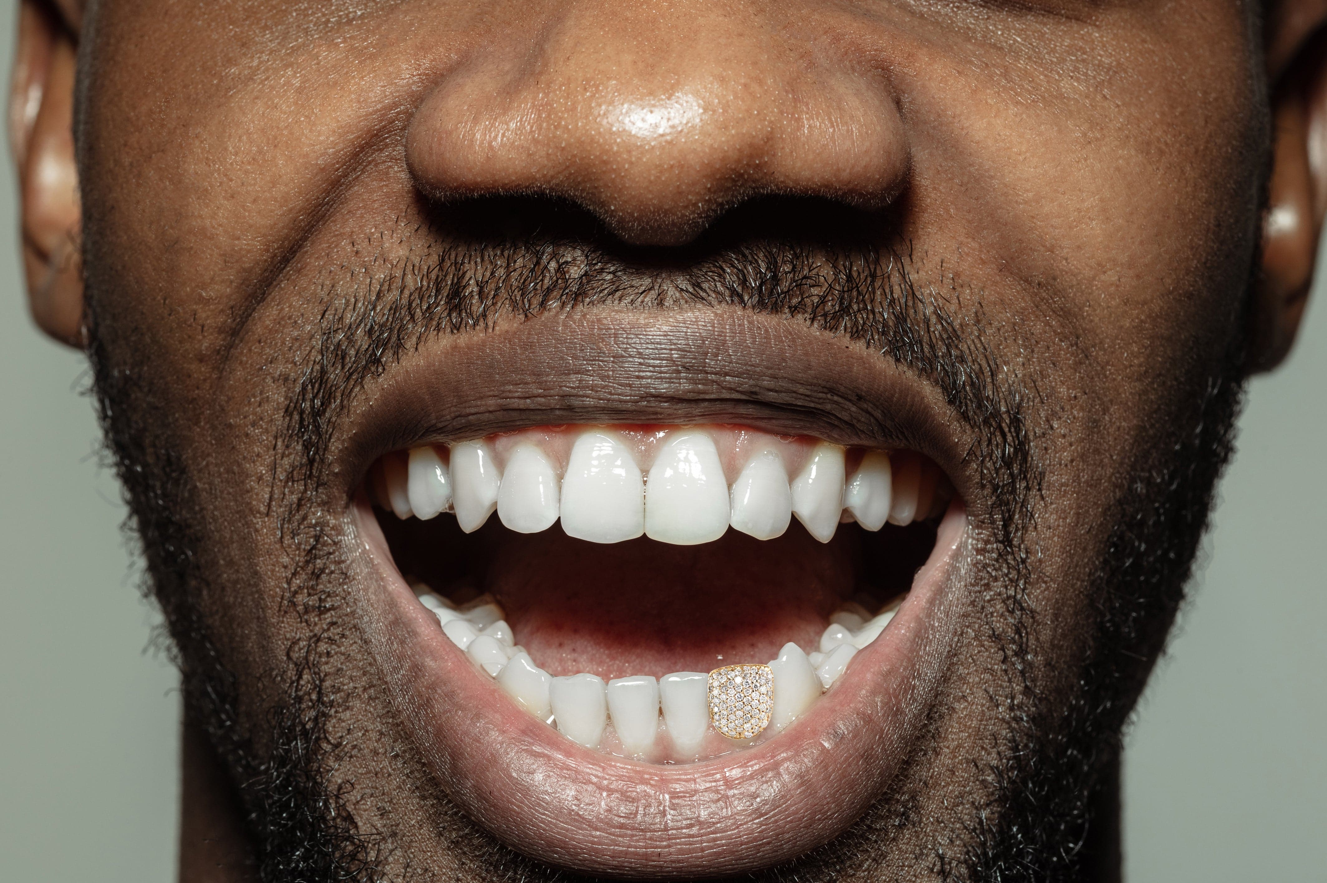 Gold And Diamond One Tooth Cap Grills - Image 4