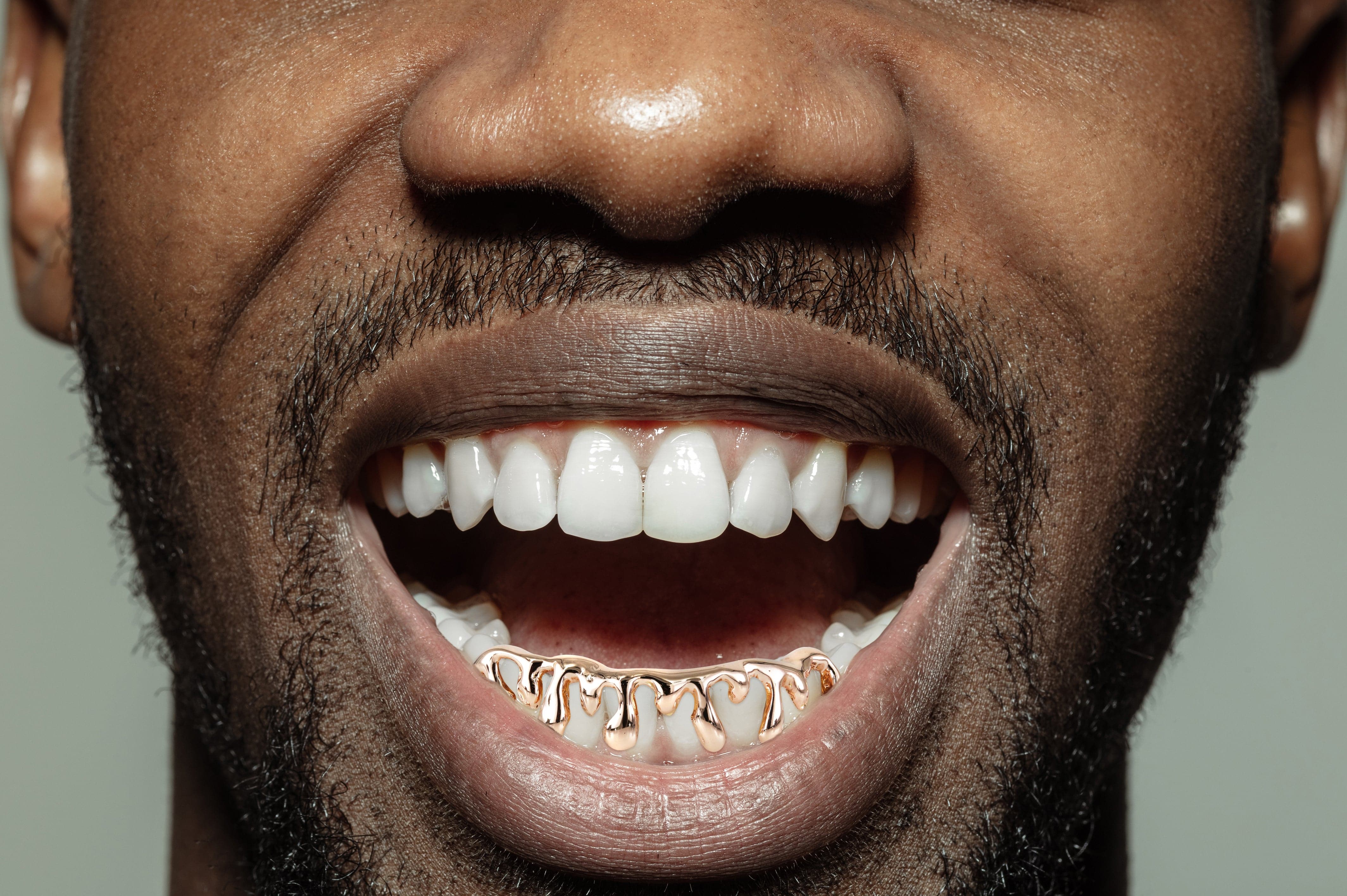 Gold 6 Teeth Drip Grills - Image 4