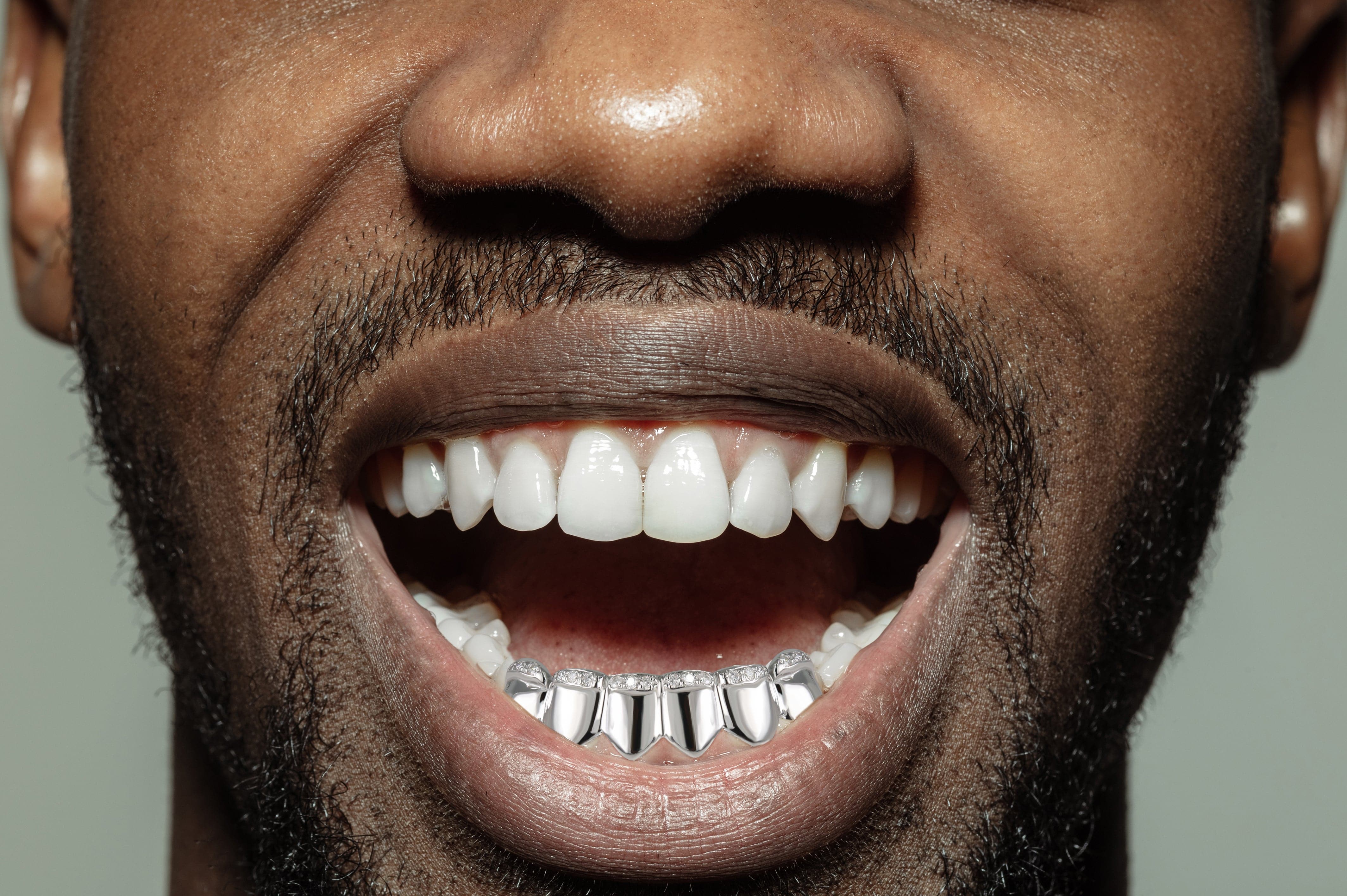 Gold 6 Teeth Diamond Grills - Image 4