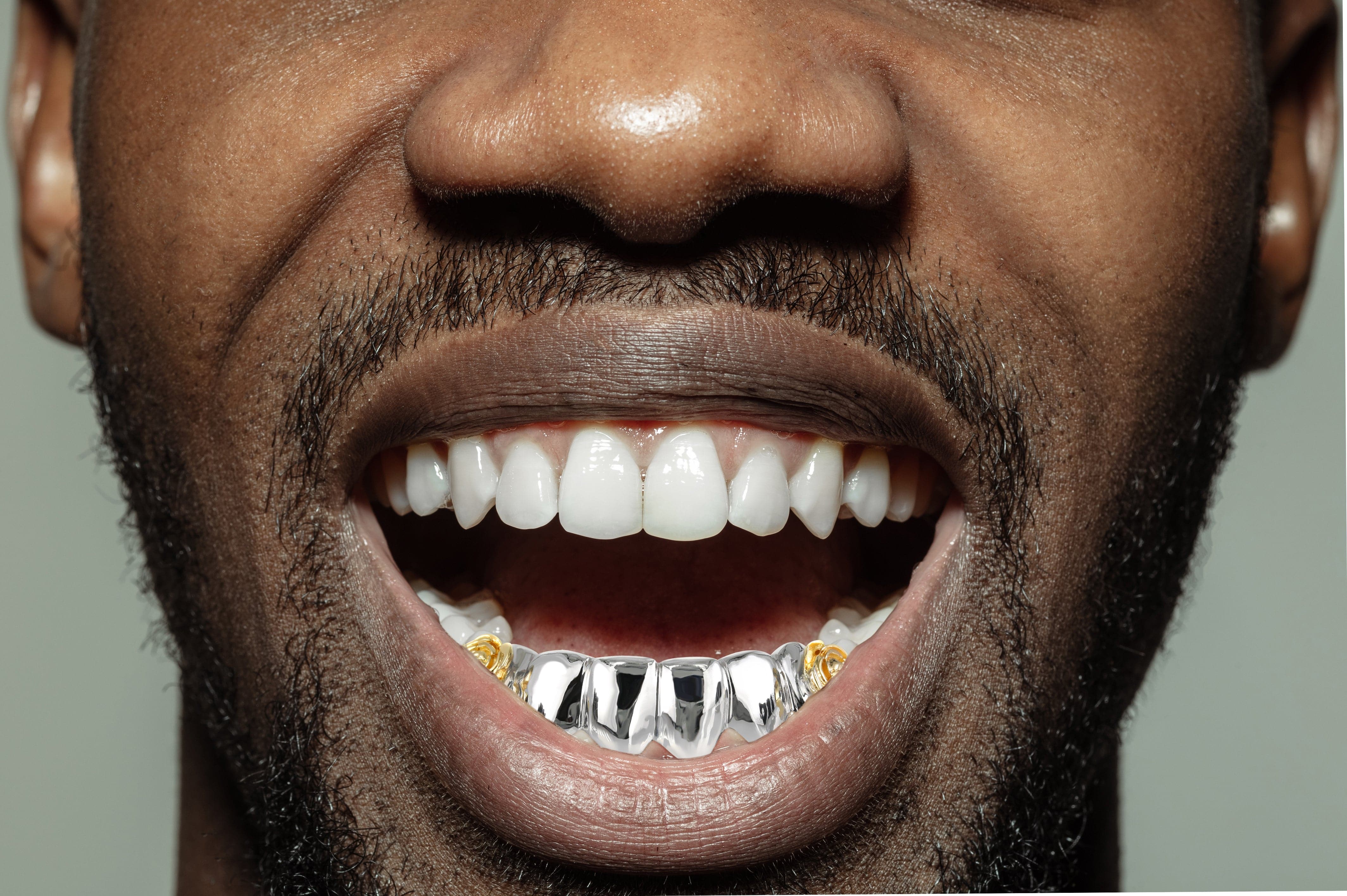 Gold 6 Tooth 3D Design Flower Grills - Image 4