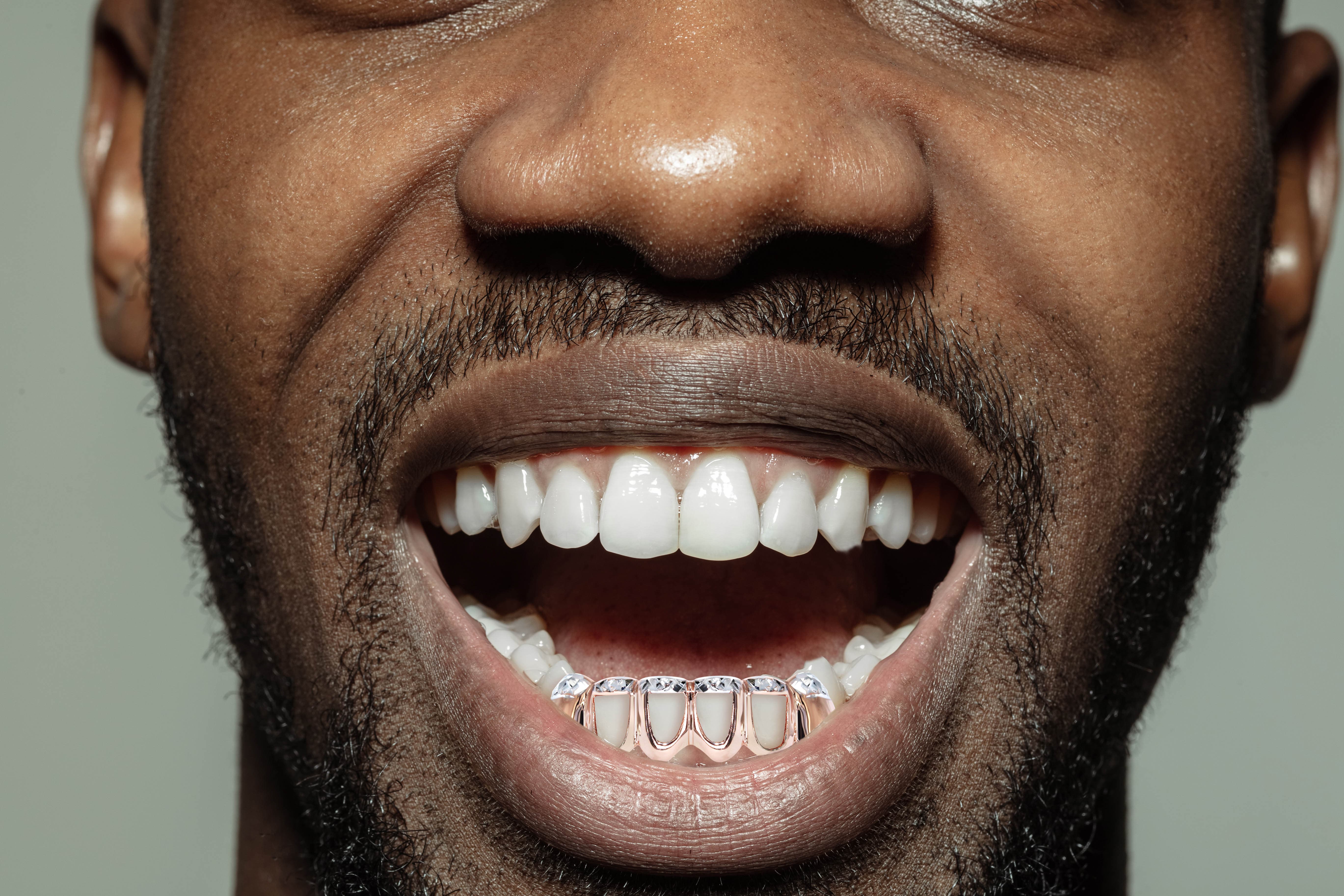 Gold 6 Teeth Two Tone Diamond Cut Grills - Image 4